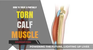 Effective Ways to Heal a Partially Torn Calf Muscle