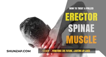 Effective Treatment Strategies for Pulled Erector Spinae Muscle Relief
