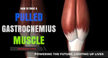 Effective Treatment Strategies for Pulled Gastrocnemius Muscle Recovery