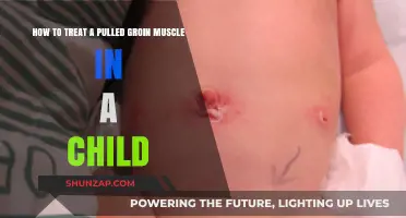 Effective Pulled Groin Muscle Treatment for Kids: A Parent's Guide