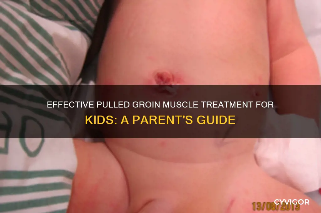 how to treat a pulled groin muscle in a child