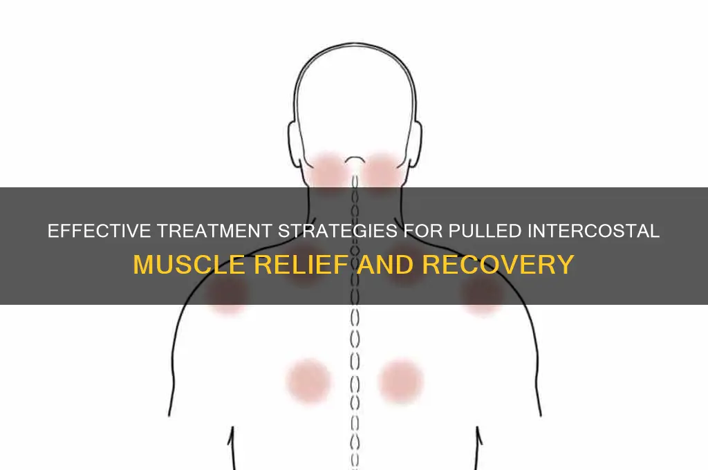 how to treat a pulled intercostal muscle