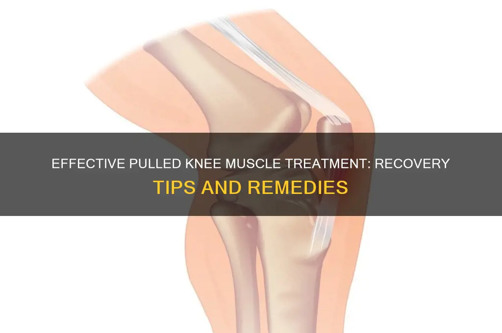 how to treat a pulled knee muscle