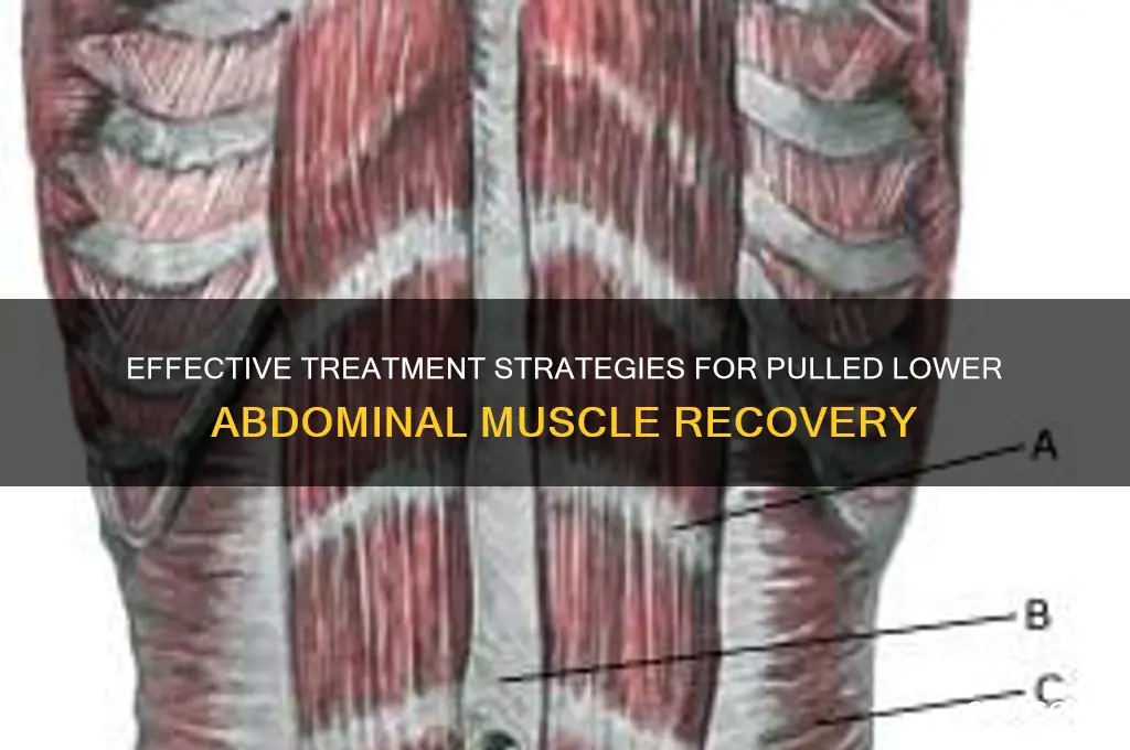 how to treat a pulled lower abdominal muscle