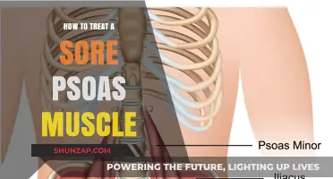 Effective Remedies for Relieving Sore Psoas Muscle Pain and Discomfort