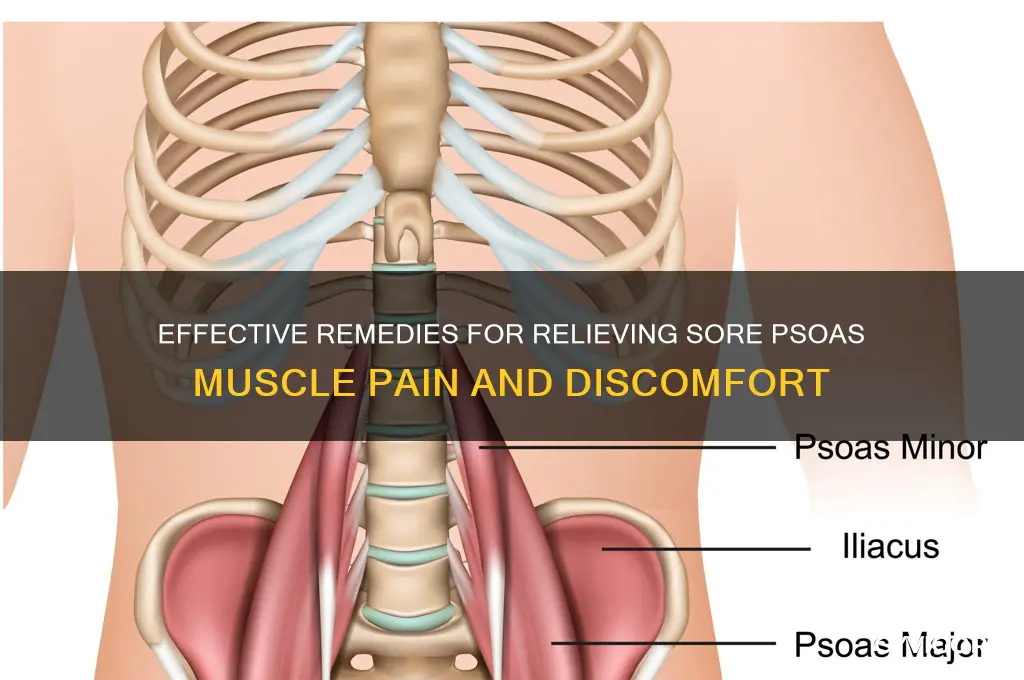 how to treat a sore psoas muscle