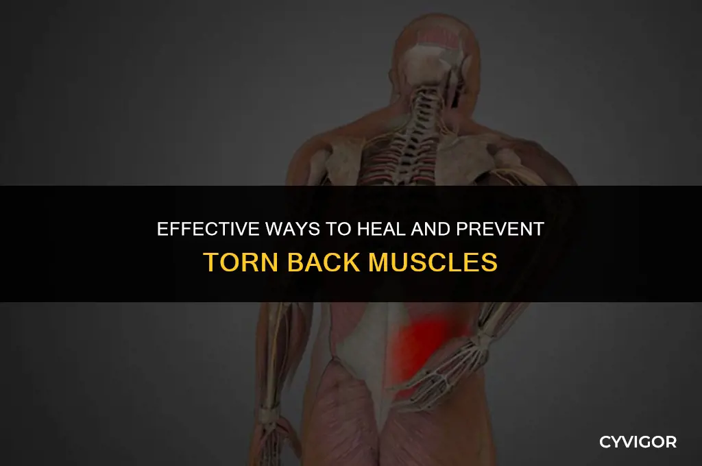 how to treat a torn back muscle