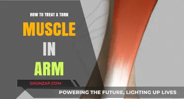 Effective Treatment Strategies for Healing a Torn Arm Muscle Quickly
