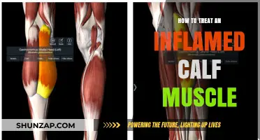 Soothing an Inflamed Calf Muscle: Effective Treatment Strategies