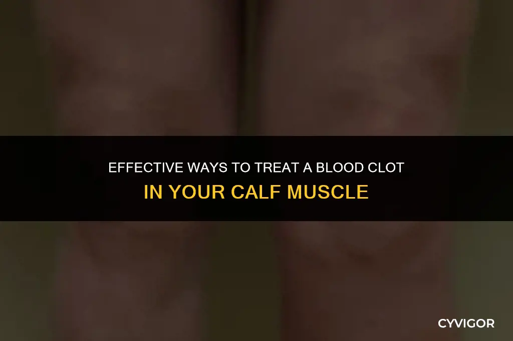how to treat blood clot in calf muscle