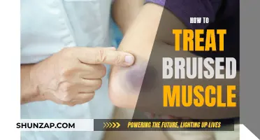 Treating Bruised Muscles: Effective Home Remedies for Quick Recovery