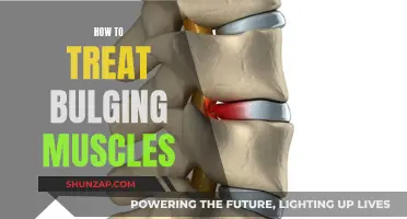 Treating Bulging Muscles: Effective Strategies for Quick Recovery