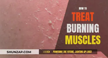 Relieving Burning Muscles: Effective Treatment Options