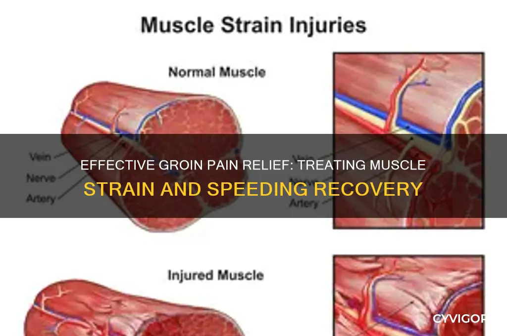 how to treat groin pain from muscle strain