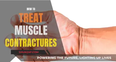 Treating Muscle Contractures: Effective Strategies for Relief and Recovery