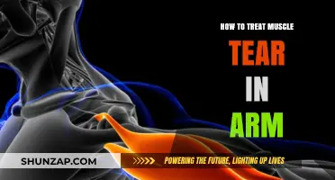 Effective Arm Muscle Tear Treatment: Healing and Recovery Tips