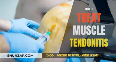 Effective Treatments for Muscle Tendonitis: What You Need to Know