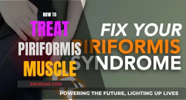 Treating Piriformis Muscle: Techniques for Relief and Recovery