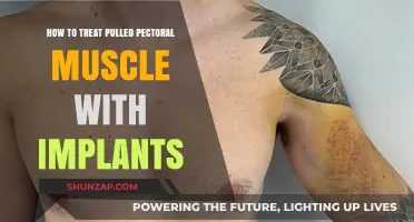 Treating Pulled Pectoral Muscles with Implants: Effective Recovery Strategies