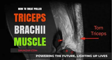 Effective Treatment Strategies for Pulled Triceps Brachii Muscle Recovery