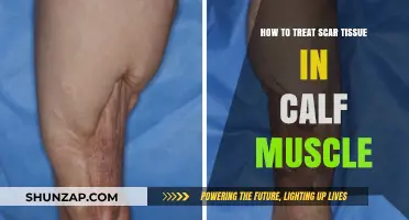 Effective Strategies for Treating Scar Tissue in Calf Muscles