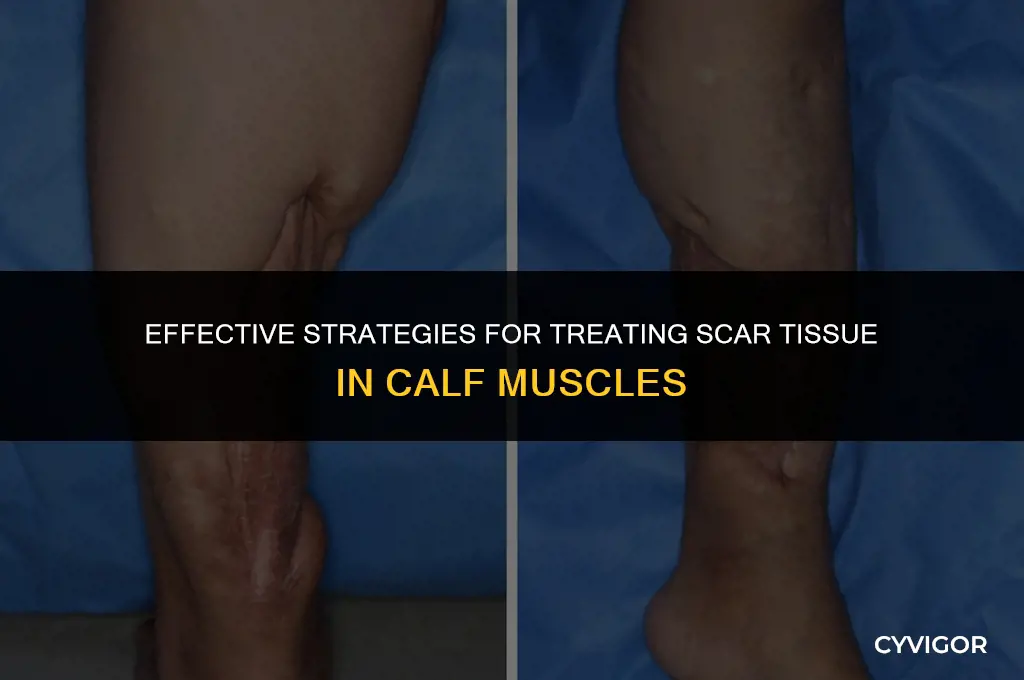 how to treat scar tissue in calf muscle