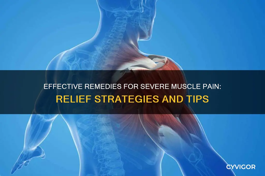 how to treat severe muscle pain