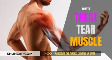 Treating a Torn Muscle: Effective Strategies for Recovery