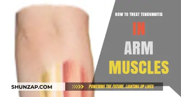 Effective Arm Tendonitis Treatment: Relief and Recovery Strategies