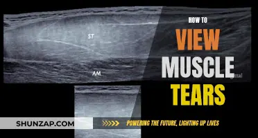 Understanding Muscle Tears: A Guide to Identifying and Treating Them