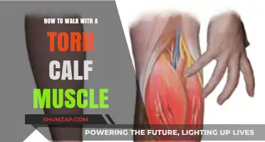 Walking with a Torn Calf Muscle: Tips and Recovery Strategies