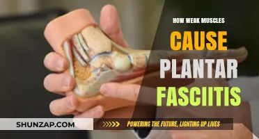 Weak Muscles: A Root Cause of Plantar Fasciitis
