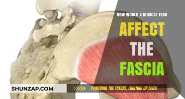 Exploring the Impact of Muscle Tears on Fascial Health