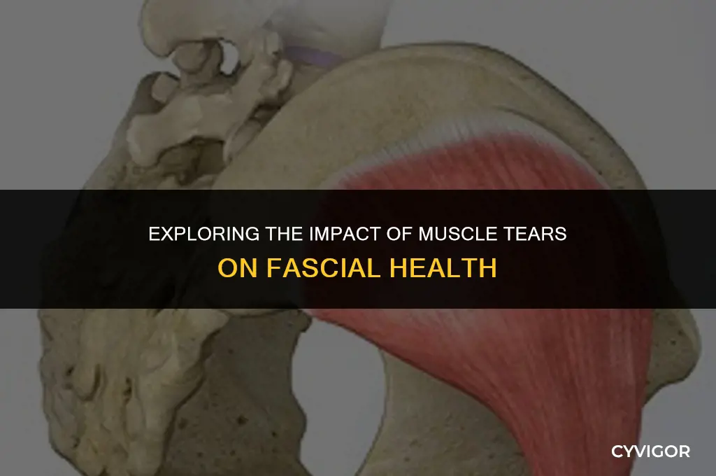 how would a muscle tear affect the fascia