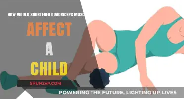 Impact of Shortened Quadriceps on Children's Mobility and Health