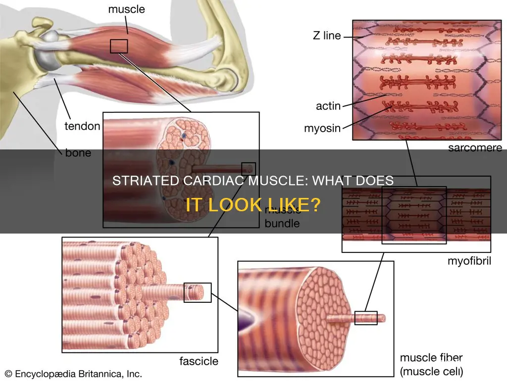 is a cardiac muscle striated