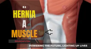 Understanding Hernias: Muscle Tears and Strains