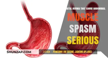 Hiatal Hernia: Abdominal Spasms and Their Severity