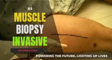 Muscle Biopsy: Invasive Procedure or Not?