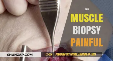 Is a Muscle Biopsy Painful? What to Expect During the Procedure