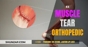 Muscle Tears: Orthopedic Emergencies and Treatment Options
