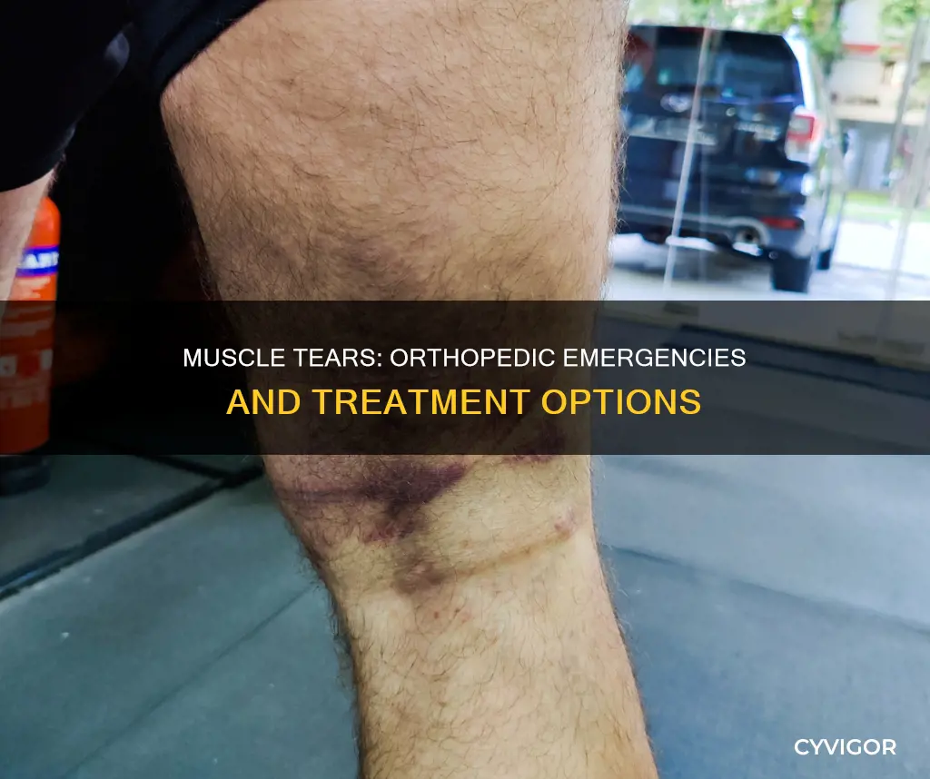 is a muscle tear orthopedic