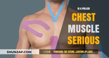 Pulled Chest Muscle: Symptoms, Treatment, and When to Seek Help