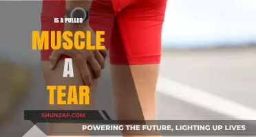 Pulled Muscle vs. Tear: Understanding the Difference and Recovery