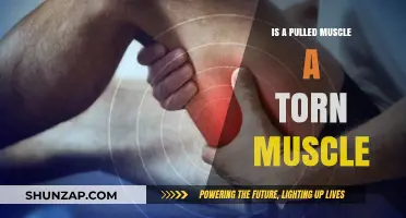 Pulled Muscle vs. Torn Muscle: Understanding the Difference and Recovery