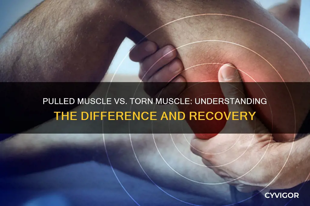 is a pulled muscle a torn muscle