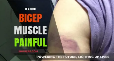 Torn Bicep Muscle Pain: Symptoms, Causes, and Recovery Explained