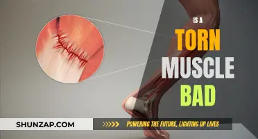 Torn Muscle Troubles: Understanding the Severity and Impact