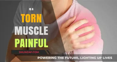 Is a Torn Muscle Painful? Understanding Symptoms and Recovery