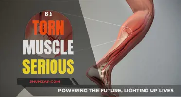 Torn Muscle: Serious Injury or Minor Setback?